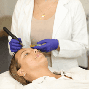 PRP Treatment at Omniya London