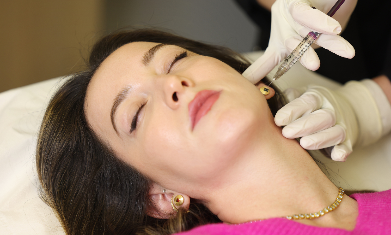 Jawline Botox treatment being perfomed at Omniya London