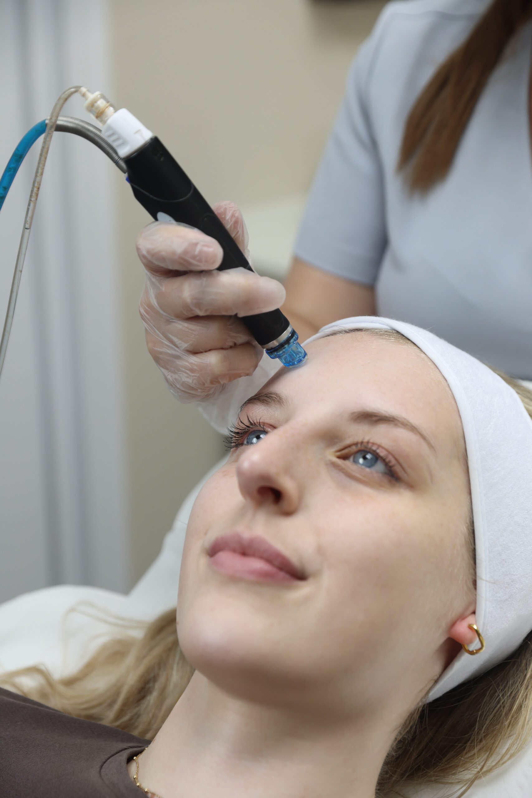 HydraFacial treatment in London