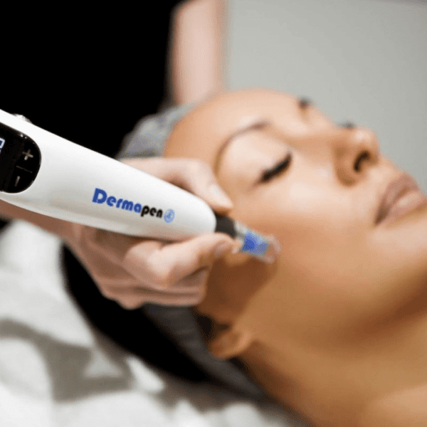 Dermapen-Microneedling treatment london